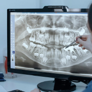 Fogorvos röntgenképet vizsgál